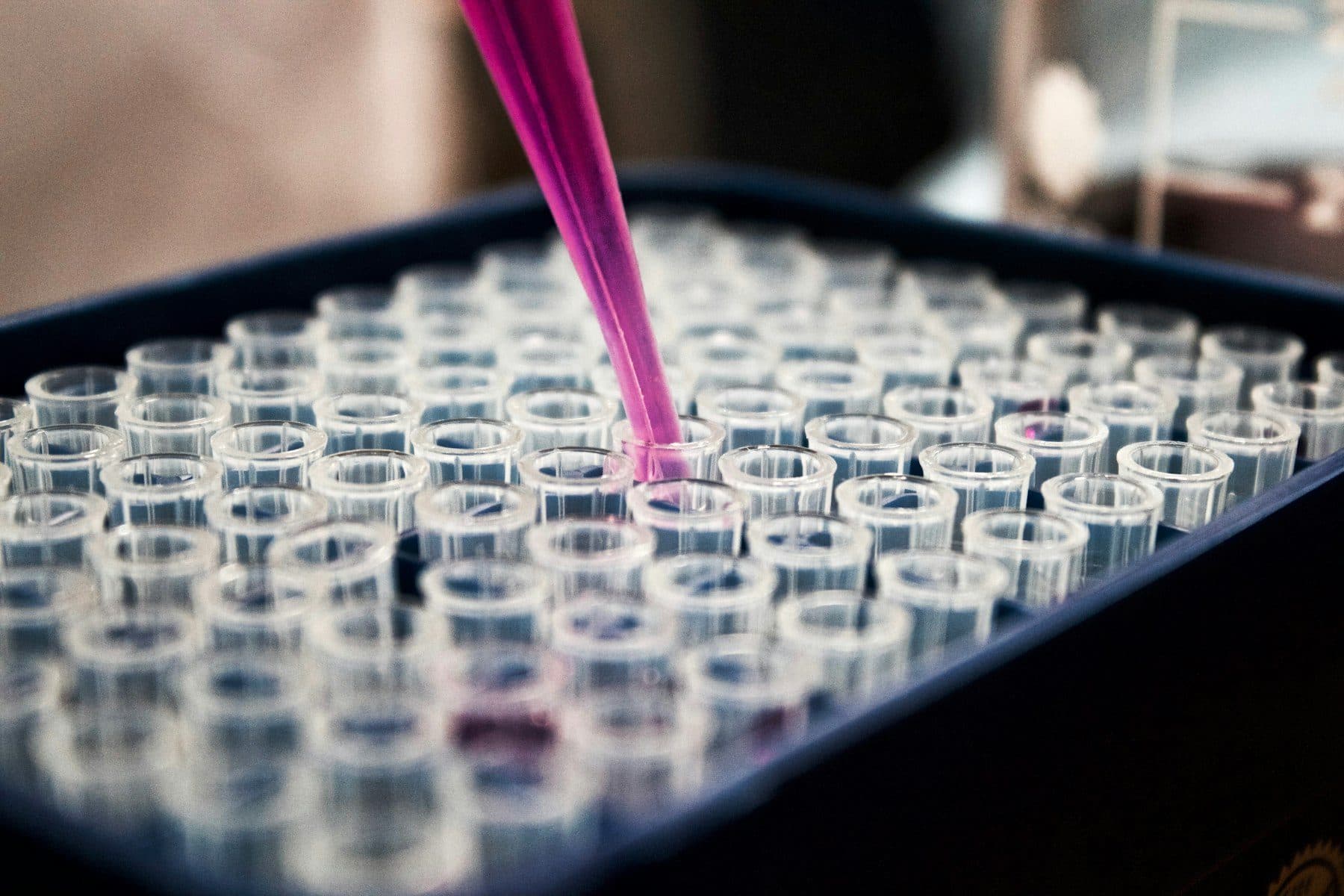 A pipette drawing a sample over a laboratory tray.