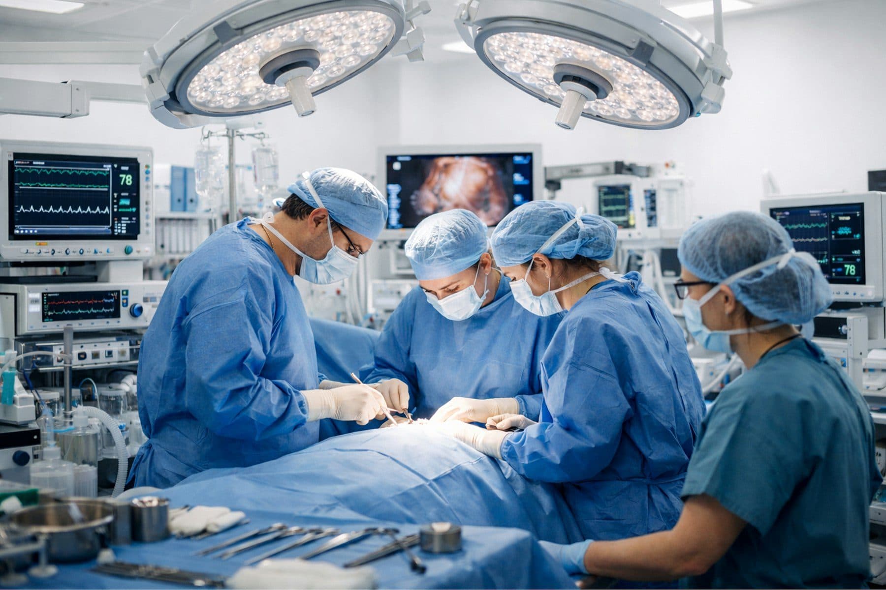 An operating theatre with its surgical team and monitors in use.